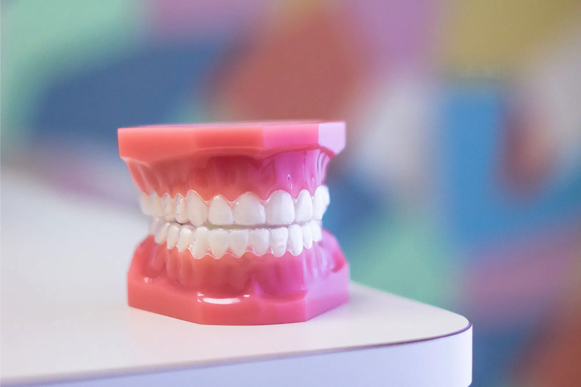 dental model showing straight white teeth under a clear aligner